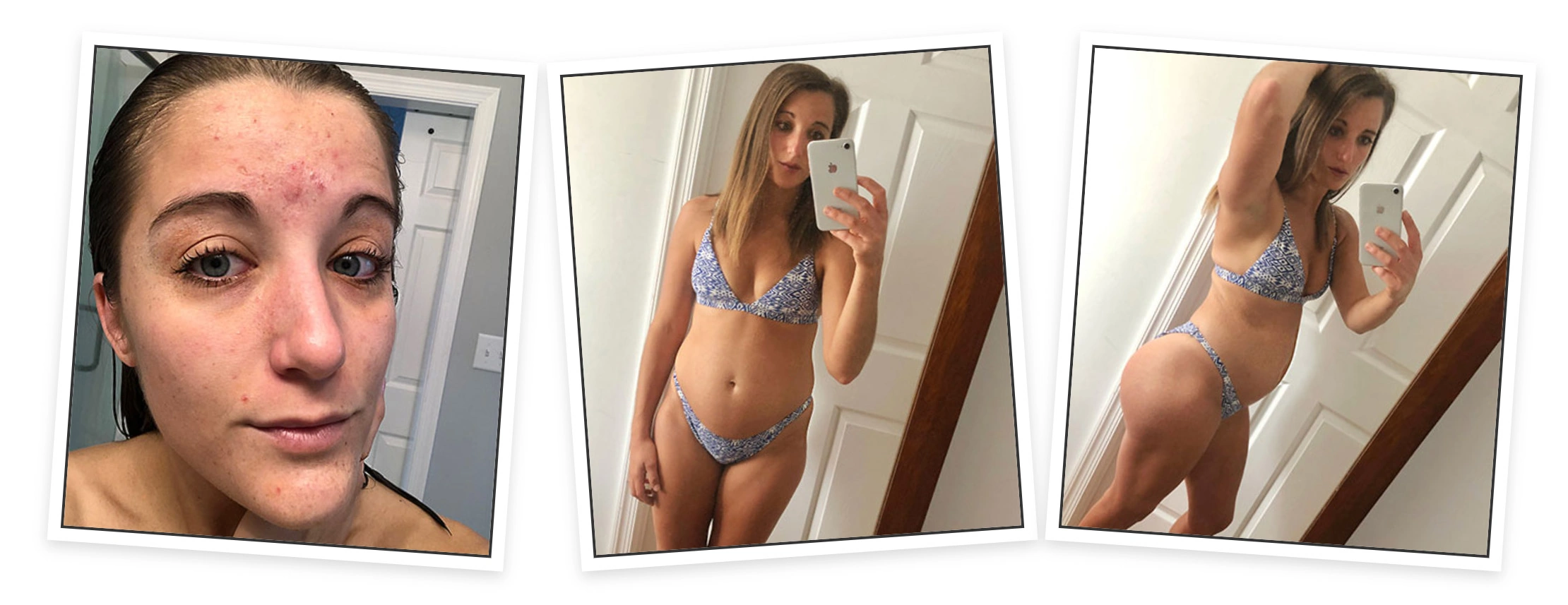 Complete Collagen Plus before and after collagen results photo
