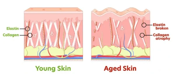 Menopause skin collagen loss visual showing skin structure changes